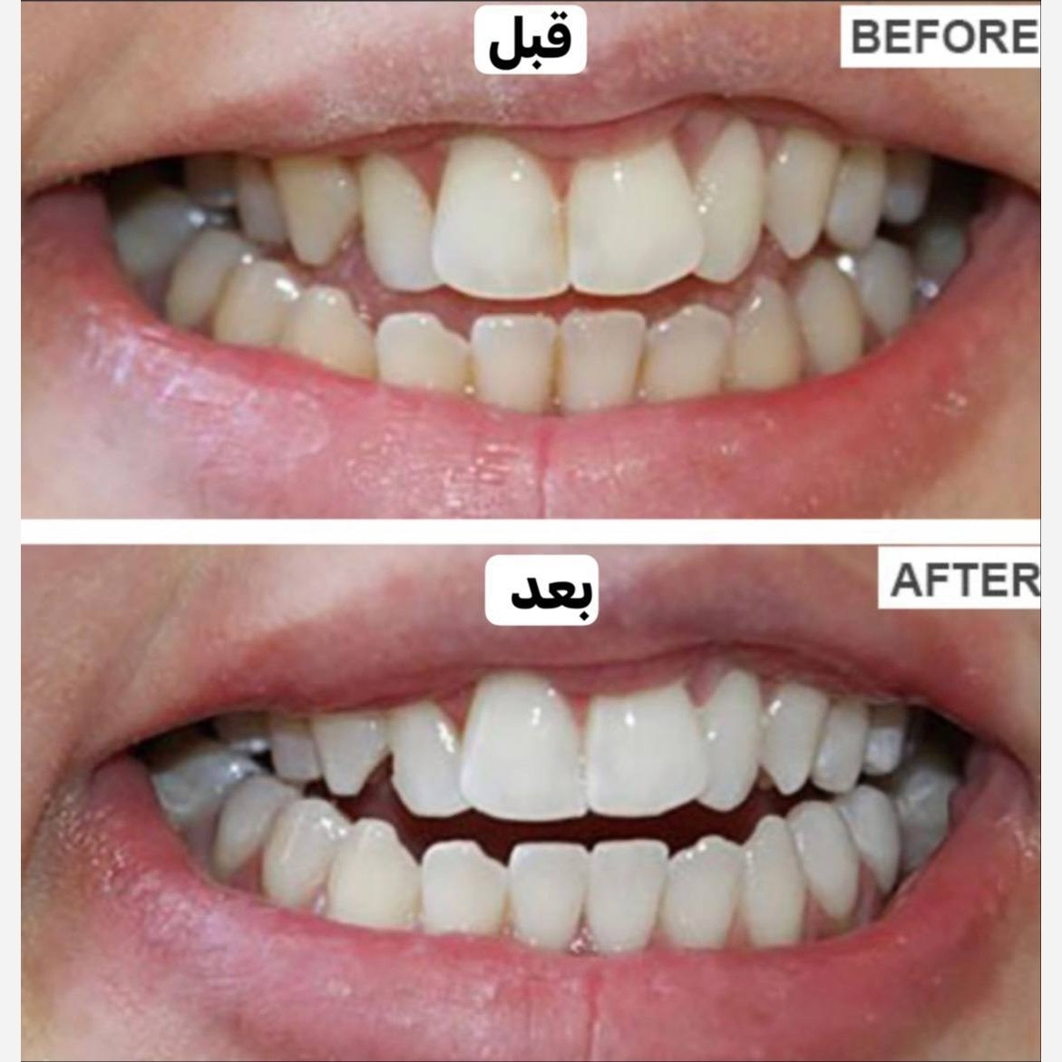 خمیر دندان سفیدکننده مارویس نقره ای